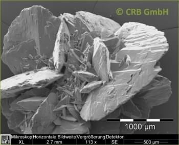 Kidney stones of calcium oxalate